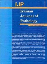 Molecular Status of BRAF Mutation in Epithelial Ovarian Cancer: An Analysis of ۵۷ Cases in the Northeast of Iran